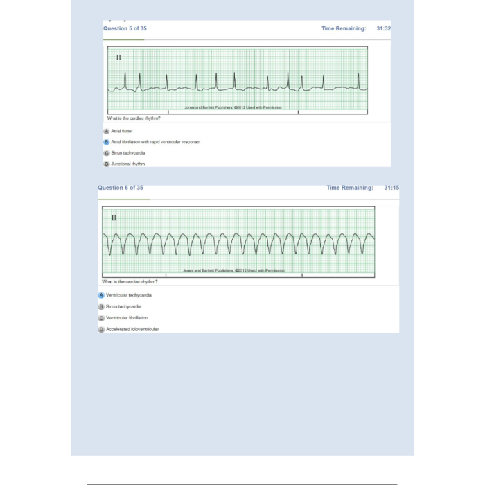 Relias Dysrhythmia Basic Test 35 Questions and Answers 2024 (Basic A Dysrhythmia)-Pass Test Bank