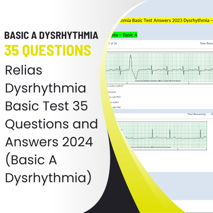Relias Dysrhythmia Basic Test 35 Questions and Answers 2024 (Basic A Dysrhythmia)-Pass Test Bank
